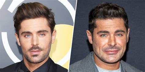 As Zac Efron Appears In New Movie Fans Speculate About Jaw Surgery