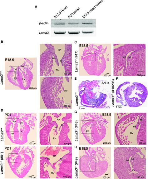 Histological Analysis Of Lama3 Knockout KO Mice A Expression Of