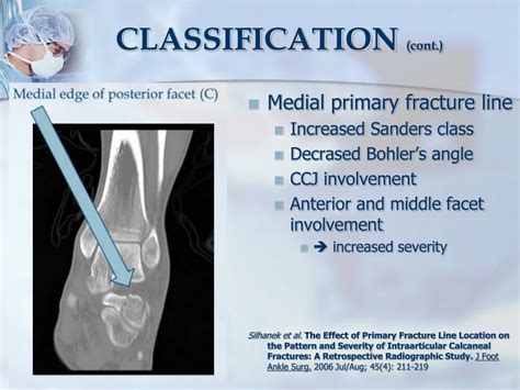 Ppt Minimally Invasive Fixation Of Calcaneal Fractures Powerpoint