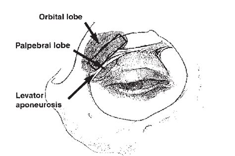 Lacrimal Fossa Location