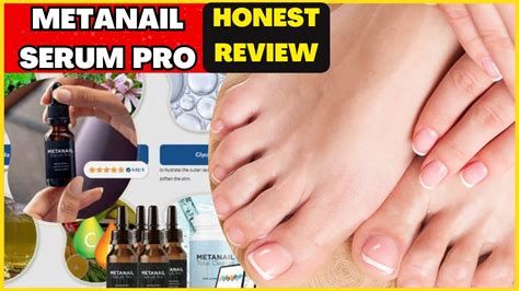 Metanail Complex Reviews 2023 The Best Nail Fungus Serum YouTube