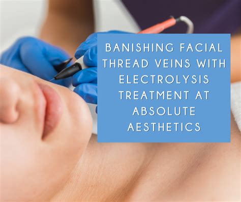 Banishing Facial Thread Veins A Guide To Electrolysis Treatment By