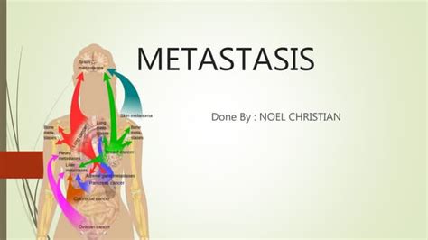 metastasis-200519200328.pdftdjtydtfktfghcgh | PPT