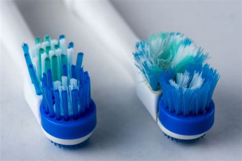 5 Signs You Need To Replace Your Toothbrush Align Dental Centre