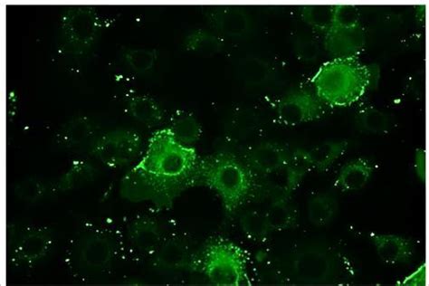 Creative Diagnostics Introduces Immunofluorescence Assay