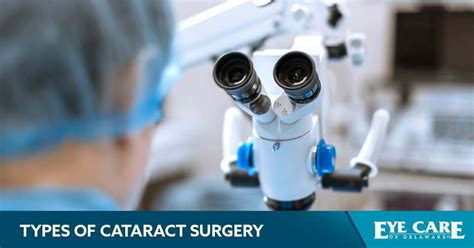 Main Types of Cataract Surgery Options – Eye Care of Delaware