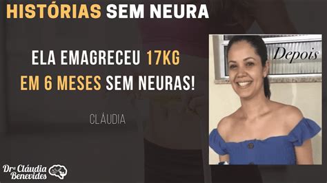 Ela Emagreceu Kg Em Meses Sem Neuras Hist Rias Sem Neuras Youtube