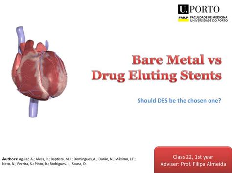 PPT - Bare Metal vs Drug Eluting Stents PowerPoint Presentation, free ...