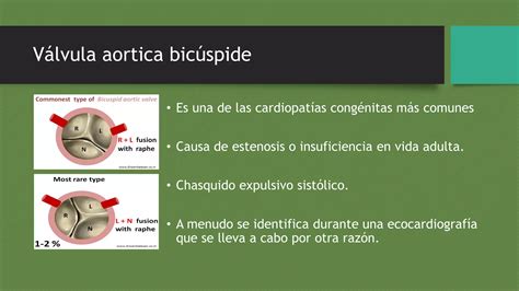 Cardiopatias Congenitas Del Adulto Ppt