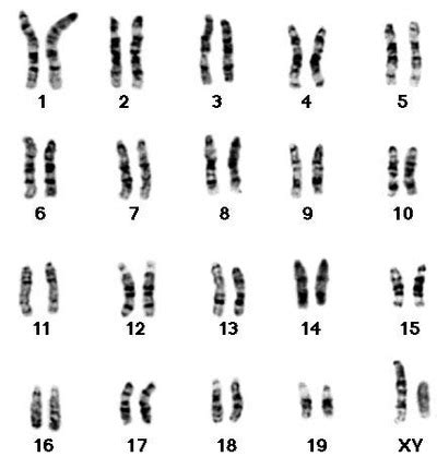 Genetics behind Cri du Chat - Cri Du Chat