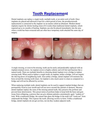 Periodontist PDF