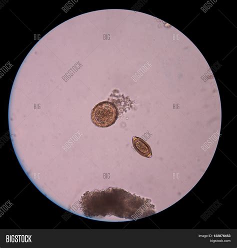 Parasites In Stool Microscope