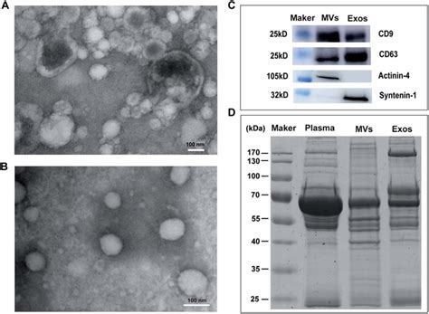 Characterization Of Microvesicles And Exosomes From Plasma TEM Images