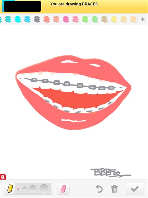 Braces Drawing At Getdrawings Free Download