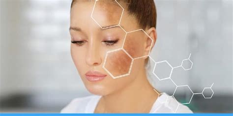 Glutathione Injection For Hyperpigmentation And Dark Circles