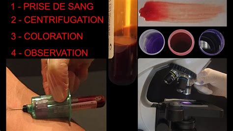 Prise De Sang Humain Centrifugation Frottis Coloration