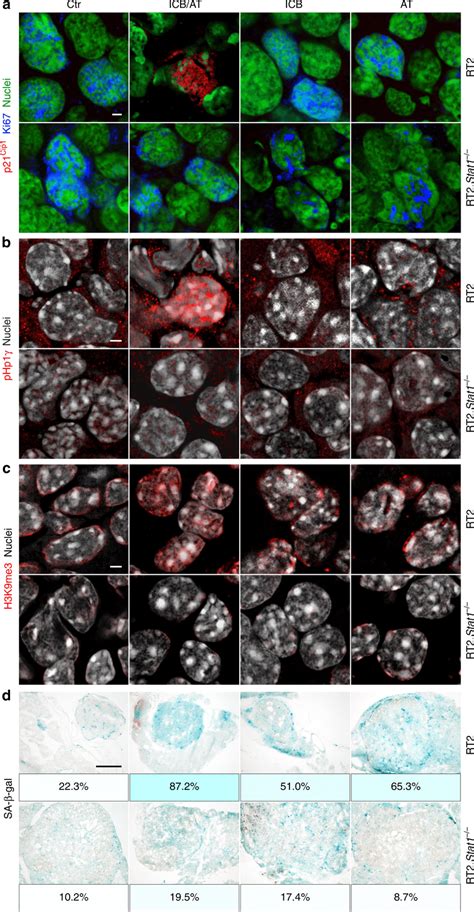 Stat Dependent Induction Of The Nuclear Senescence Markers P Cip