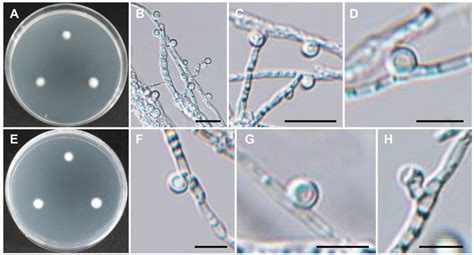 Morphology Of Tetracladium Globosum Cnufc Cpws 1 Ae Colonies On