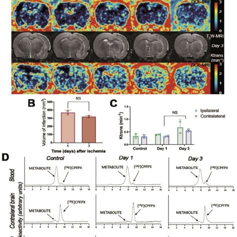 Magnetic Resonance Imaging Mri T2 Weighthing T2w Dynamic