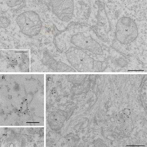 Immunoelectron Microscopic Localization Of Appl1 Hela Cells Were