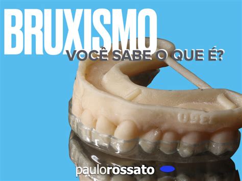 Bruxismo Voc Sabe O Que Paulo Rossato