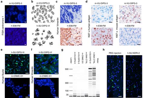 Human Dipg Cells Injected Directly From The Human Brain To The Mouse