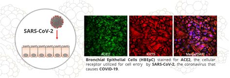 Airway Epithelial Cells