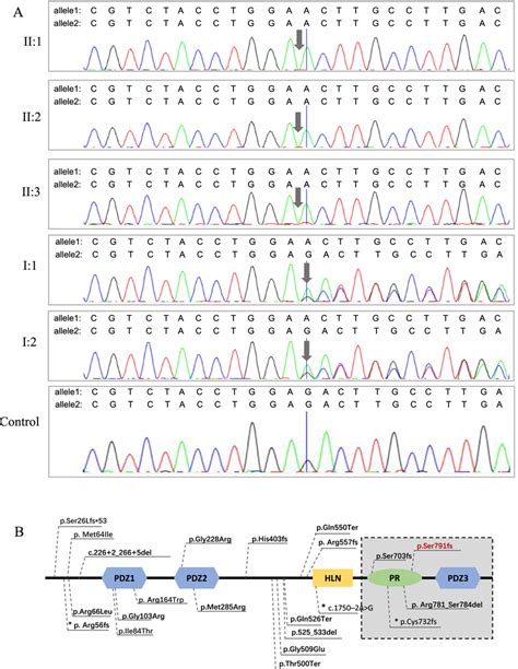 Sanger Sequencing Of The Pathogenic Variant A Sanger Sequencing