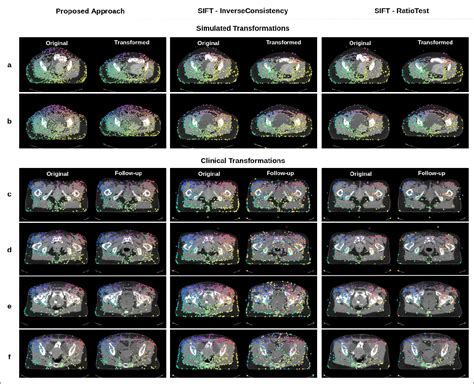 [pdf] An End To End Deep Learning Approach For Landmark Detection And