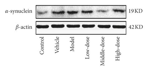 Expression Of Synuclein In The Substantia Nigra Of Rats A