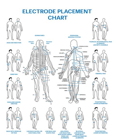 Electrode Placement Chart Esa Medical