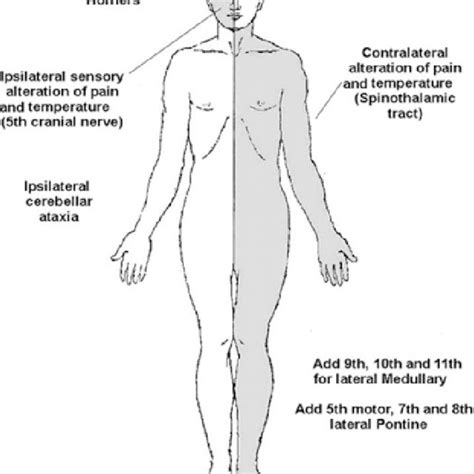 (PDF) The rule of 4 of the brainstem: A simplified method for ...