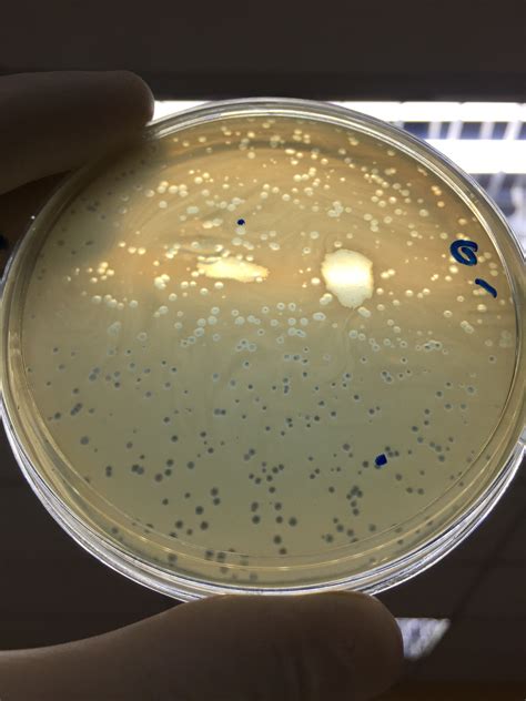 Is this lytic or lysogenic phage ? | ResearchGate