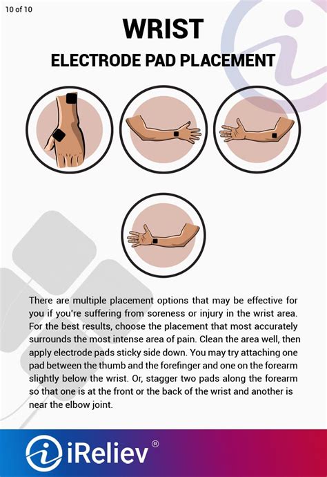 Tens Unit Electrode Placement Guide Artofit