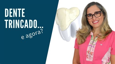 Dentes Trincados O Que Fazer - Dente Trincado: O Que Fazer? - Dra. Cíntia Amorim - Adornare ...