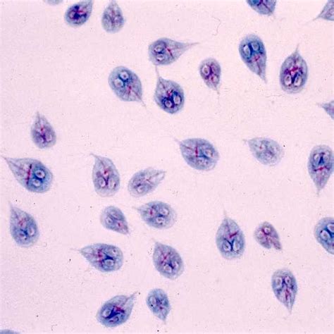 Illness & Symptoms| Giardia | Parasites | CDC