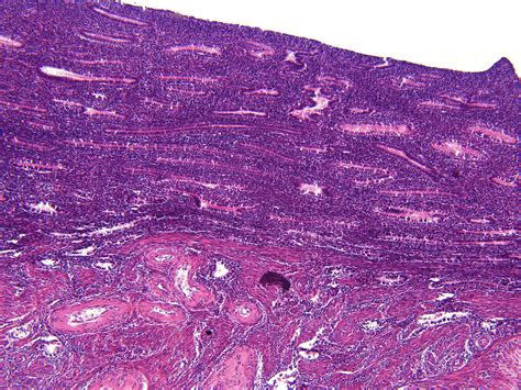 Uterus Early Proliferative Phase 100 X Anatomicum