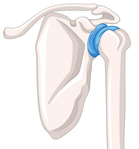 Long Bone Fractures Profile