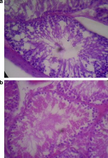 Histological Sections Of Testis Of Sprague Dawley Rats In Group