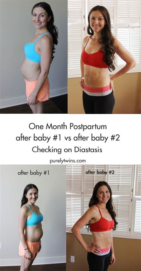 One Month Postpartum Diastasis Update After Baby 2 And Bellies Inc