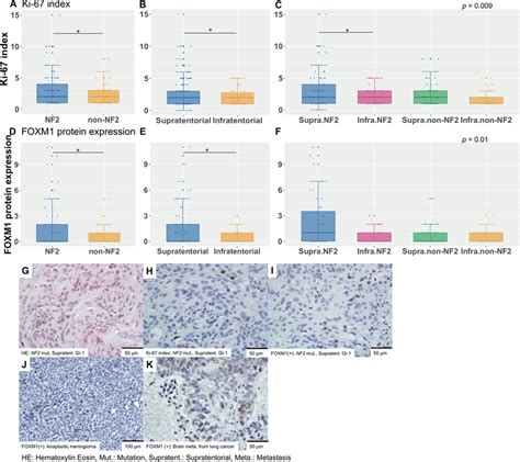 Ki 67 Index And FOXM1 Protein Expression In WHO Grade I Meningioma With