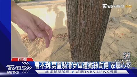 痛男童至公園玩遭鐵絲勒脖 疑2童惡作劇｜tvbs新聞 Tvbsnews01 Youtube