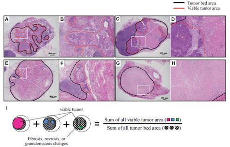 Pathological Regression Of Lymph Nodes Better Predicts Esophageal