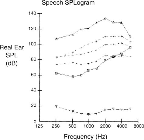 Effects Of Compression On Speech Acoustics Intelligibility And Sound Quality Pamela E Souza