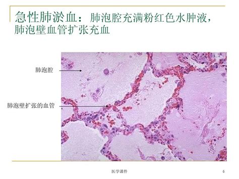 病理学图片库 Ppt课件word文档在线阅读与下载无忧文档