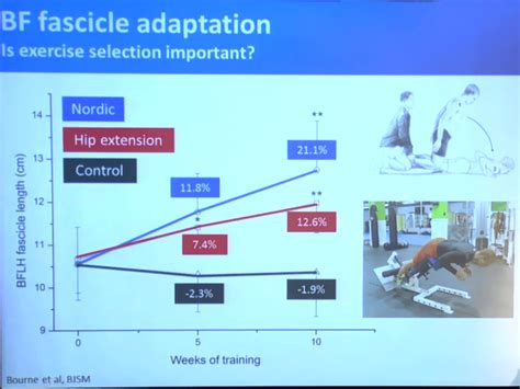 Hamstring Rehab Exercises Everything You Need To Know