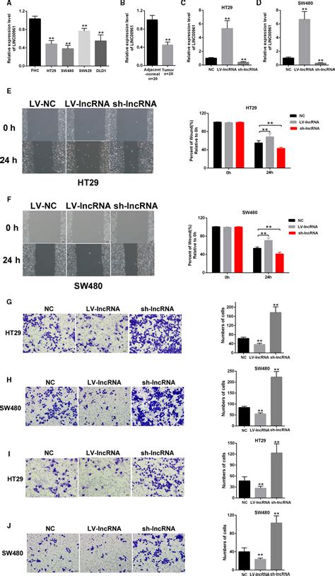 Linc Inhibits The Migration And Invasion Of Colon Cancer Cells By