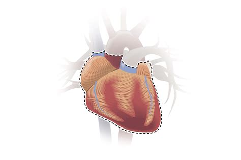 Why Your Odds of Getting a Heart Transplant Are So Low | TIME