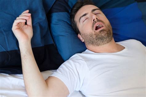 Mengenal Apa Itu Sleep Apnea Gejala Penyebab Dan Cara Mengatasinya