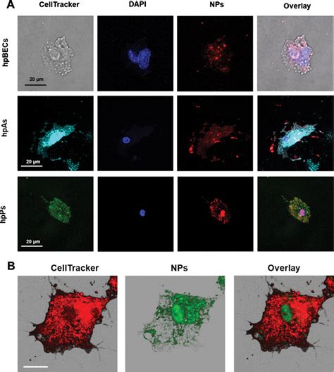 A Confocal Laser Scanning Microscopic Images To Demonstrate The Uptake